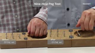 recoveriX Neurorehabilitation for Stroke  Nine Hole Peg Test BeforeAfter Video [upl. by Pironi]