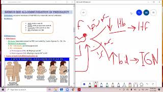 د السكري erythroblastosis fetalis rh [upl. by Brookhouse]