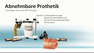 Abnehmbare Totalprothetik – Kapitel 3 [upl. by Yelekreb]