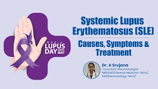 Systemic Lupus Erythematosus SLE Causes Symptoms amp Treatment  Medicover Hospitals [upl. by Ninette]