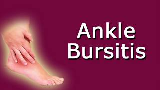 Ankle Bursitis [upl. by Namharludba17]