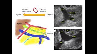 Anatomía hepatobiliopancreática aplicada a la ecoendoscopía [upl. by Naujej]