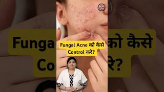 How to treat Fungal Acne on face  Fungal Acne Treatment fungalacne acne skincare shorts [upl. by Bred]