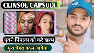 Clinsol capsule uses in hindi how to take clinsol capsule full review in hindi [upl. by Siubhan671]