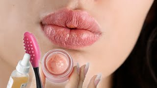 DRY LIPS 101 [upl. by Giovanni]