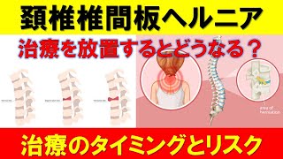 頚椎椎間板ヘルニアの症状と治療法【必見】首の痛みとしびれを解消する方法 [upl. by Weston]