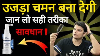 Man Matters Minoxidil Review 😇 Man Matters Minoxidil कर देगी टकला बाल बचाने हैं तो देख लो😰 [upl. by Concettina]