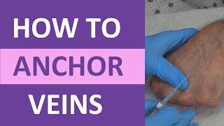 How to Anchor Veins  Venipuncture IV Therapy Blood Draw Phlebotomy Rolling Veins [upl. by Wulf]