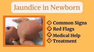 “Why Do Newborns Turn Yellow Understanding Jaundice in Babies” baby newborn newparentsguide [upl. by Peale588]