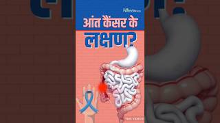 Intestine Cancer Symptomsआंत कैंसर के इन लक्षणों को ना करें इग्नोंर shorts ytshorts trending [upl. by Eidoj]