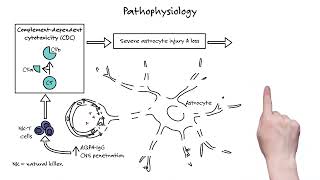 Neuromyelitis Optica Spectrum Disorder Updates on Diagnosis and Treatment Management [upl. by Marra226]