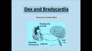 Dexmedetomidine A to Z by dr tushar chokshi [upl. by Camala150]