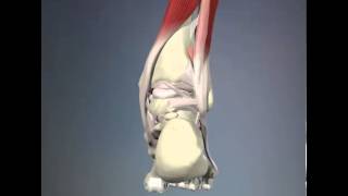 Retro Calcaneal Bursitis presented by The foot Mechanic™ [upl. by Cissiee]