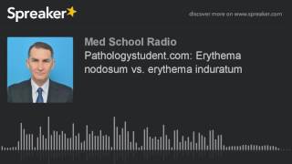 Pathologystudentcom Erythema nodosum vs erythema induratum made with Spreaker [upl. by Trebleht252]