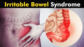 What Happens in Irritable Bowel Syndrome IBS  Symptoms Causes and Treatment UrduHindi [upl. by Wieche]