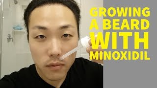 Can Asians Grow Beards With Minoxidil [upl. by Anilas297]