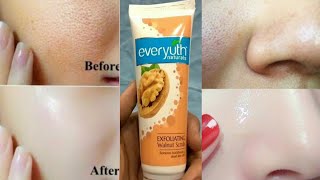 How to Use Face Scrubs  Everyuth ScrubHow to Apply Face Scrub at Home Hindi [upl. by Sivar455]