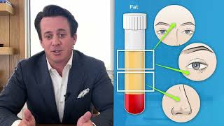 Fat Component Transplantation by Donald S Mowlds MD MBA [upl. by Dressel432]