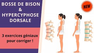 3 exercices géniaux pour réduire la BOSSE DE BISON 👍 [upl. by Philbin]