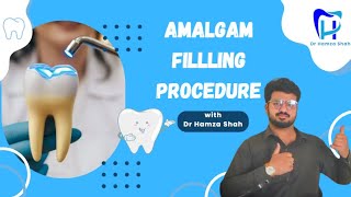 Amalgam Preparation amp Restoration  Amalgam Filling procedure  Operative Dentistry [upl. by Earehc]