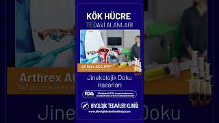 Kök Hücre Tedavi Alanları Arthrex ACA SVF®️ [upl. by Allin]