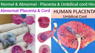 Human Placenta  Structure Function amp Abnormalities of Placenta amp Umbilical cord  Umbilical Cord [upl. by Yddor]