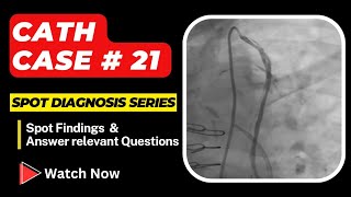 Cardiac Cath Case 21 Spot Diagnosis Series  Interventional Cardiology heart [upl. by Malcolm260]