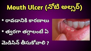 Mouth Ulcers Reasons and Treatment in Telugu [upl. by Ludovico]