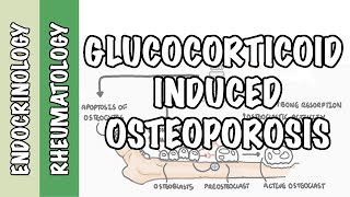 Glucocorticoid Induced Osteoporosis and Fractures  mechanism and pathophysiology of fractures [upl. by Jarvis]