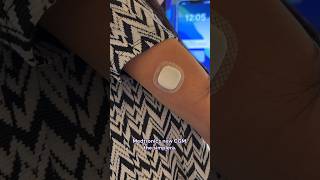 Testing the Medtronic Simplera CGM t1d diabetes [upl. by Arissa]