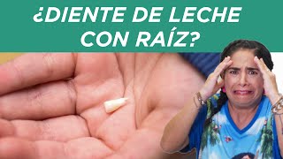 ⚠️ ¿Diente de leche con raíz [upl. by Kathryn]