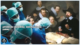 APENDİKS MÜSİNÖZ NEOPLAZİLERİ AMN [upl. by Annas599]