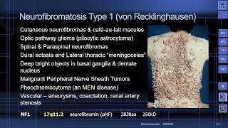 MedPix Video  The Phakomatoses von Recklinghausen Neurofibromatosis NF1 [upl. by Tiduj]