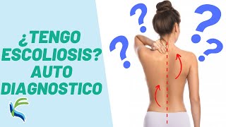 ¿CÓMO saber si TENGO ESCOLIOSIS Auto Diagnostico  Fisiolution [upl. by Wiltshire]