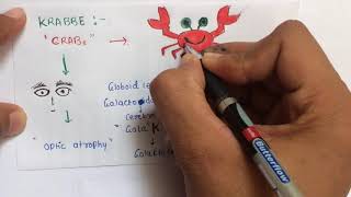 Lysosomal storage diseases mnemonic  USMLE  NEETPG  AIIMS [upl. by Llewsor]