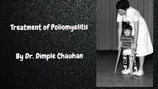 Polio Treatment  Poliomyelitis Treatment [upl. by Filberte130]