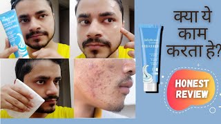 यह Viral Video का सच यहाँ देखें  Does Salicylic Acid Icecream Mask Really Works for Indian Men [upl. by Eremehc]