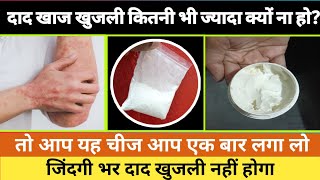 दाद खाज खुजली की 7 दिन में छुट्टी कर देगा Fungal Infection Treatment athome Daad Khaj Khujli ka ilaj [upl. by Nerat]