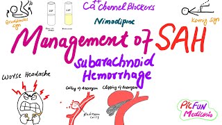 Management of Subarachnoid HemorrhageSAHbrain hemorrhage [upl. by Downe299]