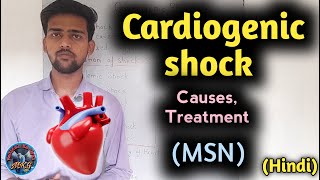 Cardiogenic shock  cardiogenic shock in hindi  cardiogenic shock nursing  MSN  medicalkagyan [upl. by Hairam117]