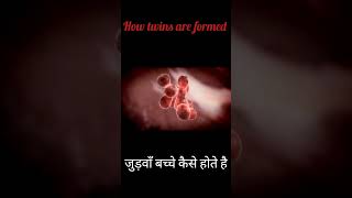 जुड़वाँ बच्चे कैसे होते हैhow twins are formedbaby pregnancy [upl. by Noemys]