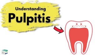 What is Pulpitis  Endodontics [upl. by Ariad]