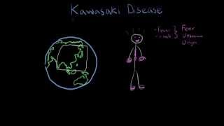 What Is Kawasaki Disease [upl. by Mikah]