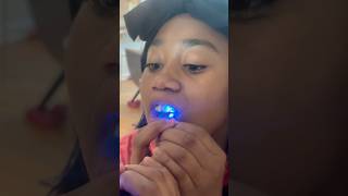 Diamond Teeth Kit DIY ❗️Diamond Veneers on my teeth fypシ゚ royalrose viralvideos comedy lol￼ [upl. by Ennahtebazile]