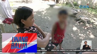 Bata sinakmal ng aso sa mukha  Unang Balita [upl. by Novyak637]