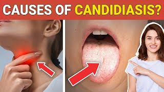 10 Shocking 😳 Causes of Candidiasis that you Might dont Know  Credihealth [upl. by Doowle]