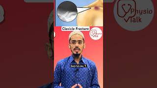 Everything You Wanted to Know About Clavicle fracture classification shorts clavicle [upl. by Jeaz904]