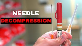 How To Chest Needle Decompression [upl. by Lucinda426]