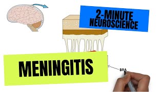 2Minute Neuroscience Meningitis [upl. by Oliana]