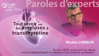 En cas d’HVG quels sont les signes échocardiographiques évocateurs d’une amylose cardiaque [upl. by Akcirret]